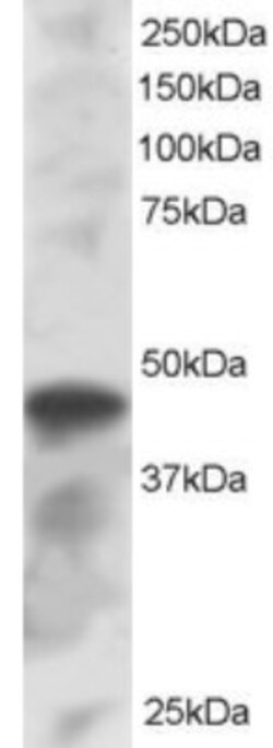 IRF8 Antibody, Novus Biologicals 0.1mg; Unlabeled:Antibodies, Polyclonal